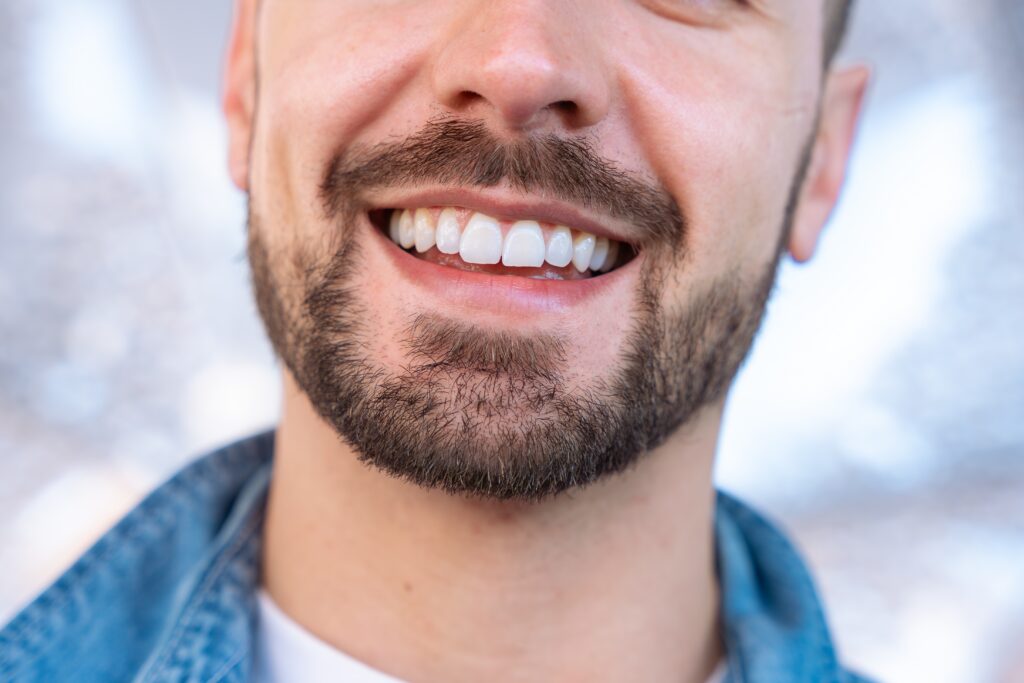 closeup of a bearded man with perfect white teeth